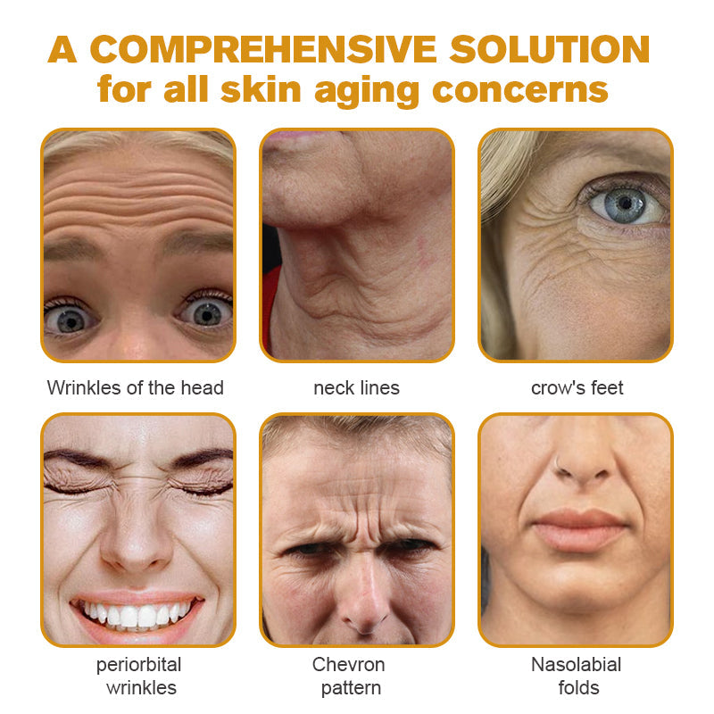 👨⚕️ Made and Shipped from USA✅ TLOPA™ Botox Bee Venom Wrinkle Removal Cream- LAST DAY 80% OFF