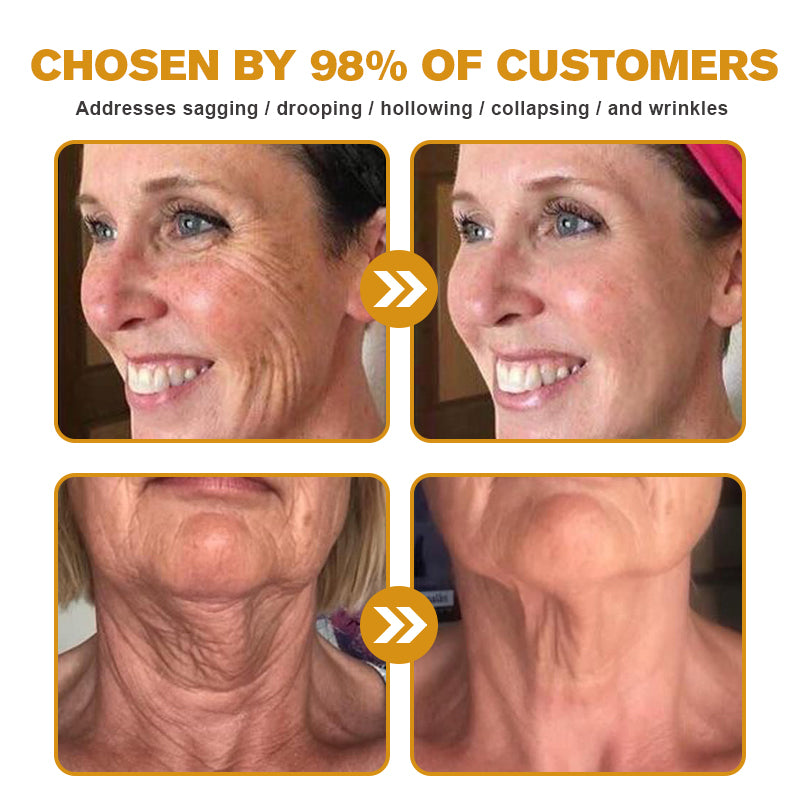 👨⚕️ Made and Shipped from USA✅ TLOPA™ Botox Bee Venom Wrinkle Removal Cream- LAST DAY 80% OFF
