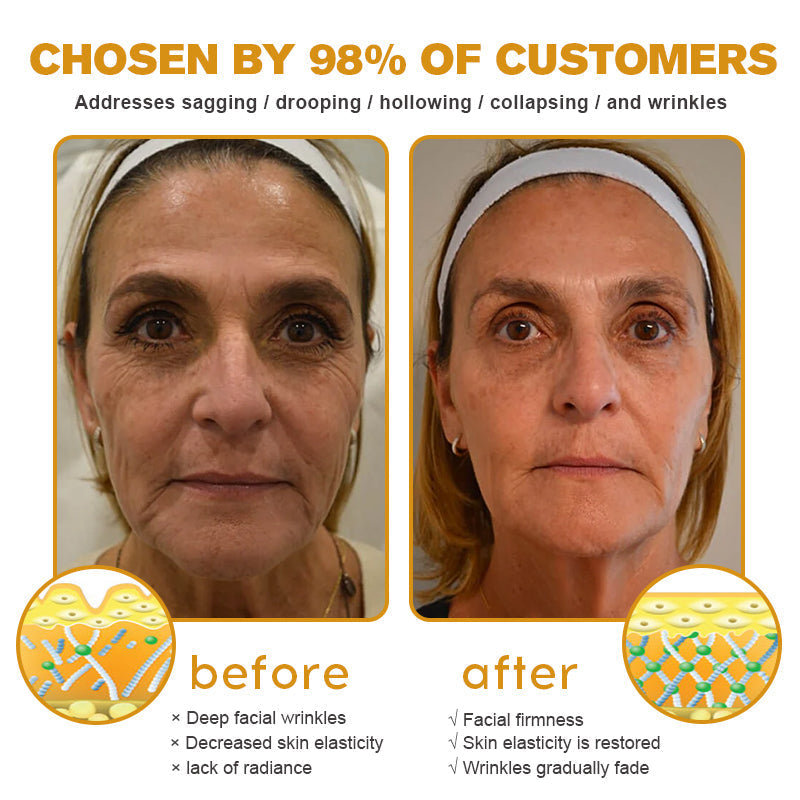 👨⚕️ Made and Shipped from USA✅ TLOPA™ Botox Bee Venom Wrinkle Removal Cream- LAST DAY 80% OFF